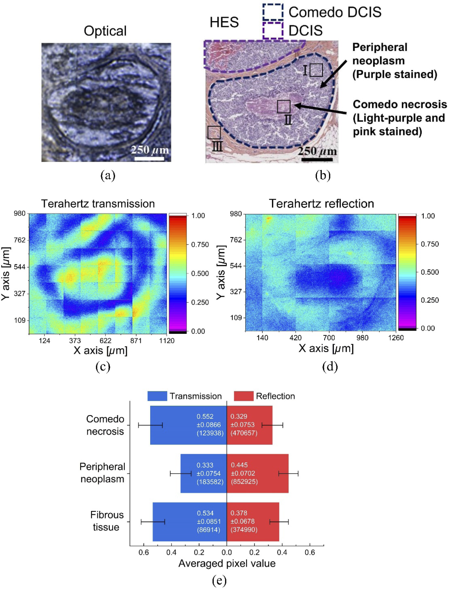 Research figure 2 associated with Scanning point terahertz source microscopy of unstained comedo ductal carcinoma in situ