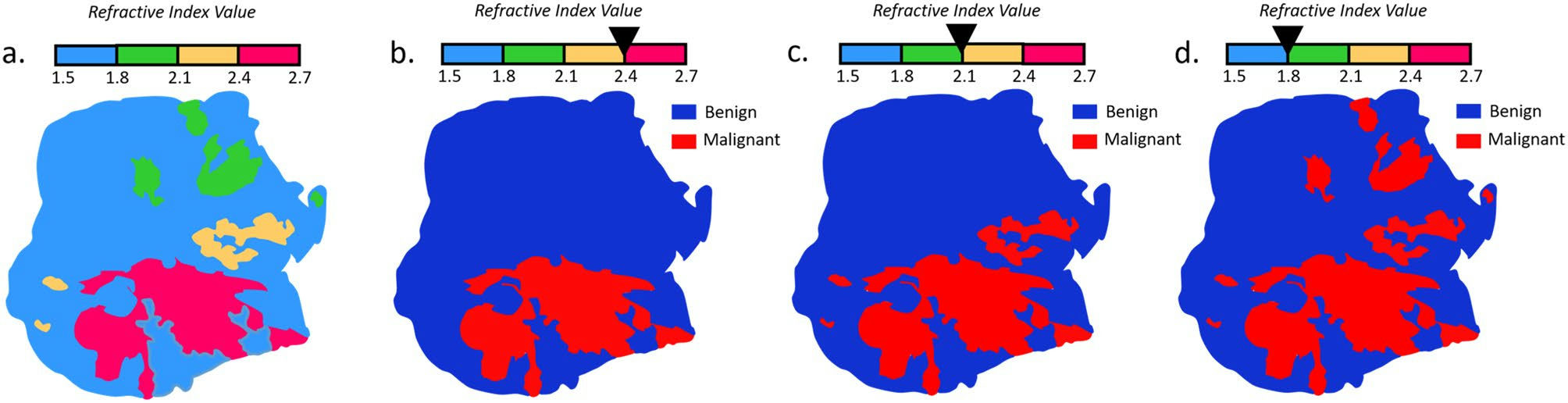 Research figure 2 associated with Terahertz refractive index-based morphological dilation for breast carcinoma delineation